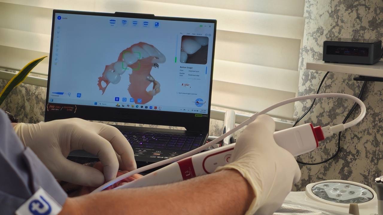 اسکن سه‌بعدی دندان بیمار توسط دکتر بابک مشایخی برای طراحی لبخند دیجیتال